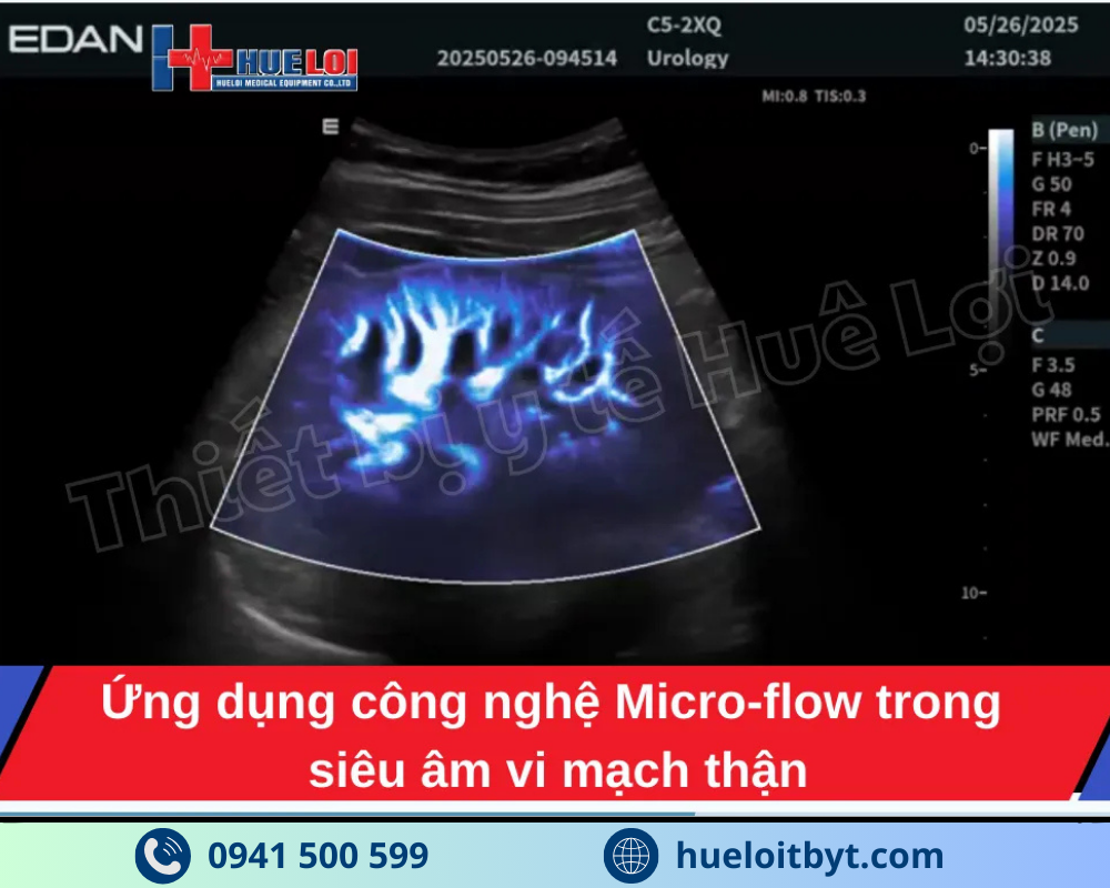 MÁY SIÊU ÂM CHẨN ĐOÁN CAO CẤP EDAN ACCLARIX LX85