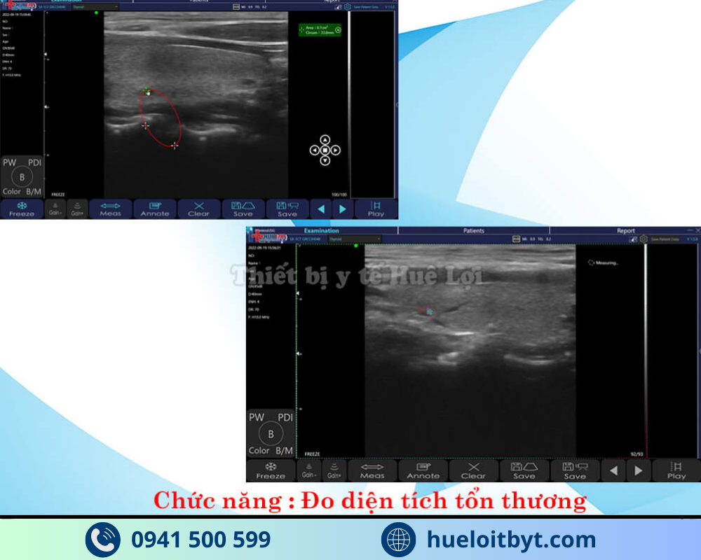 MÁY SIÊU ÂM CẦM TAY KHÔNG DÂY 3 ĐẦU DÒ