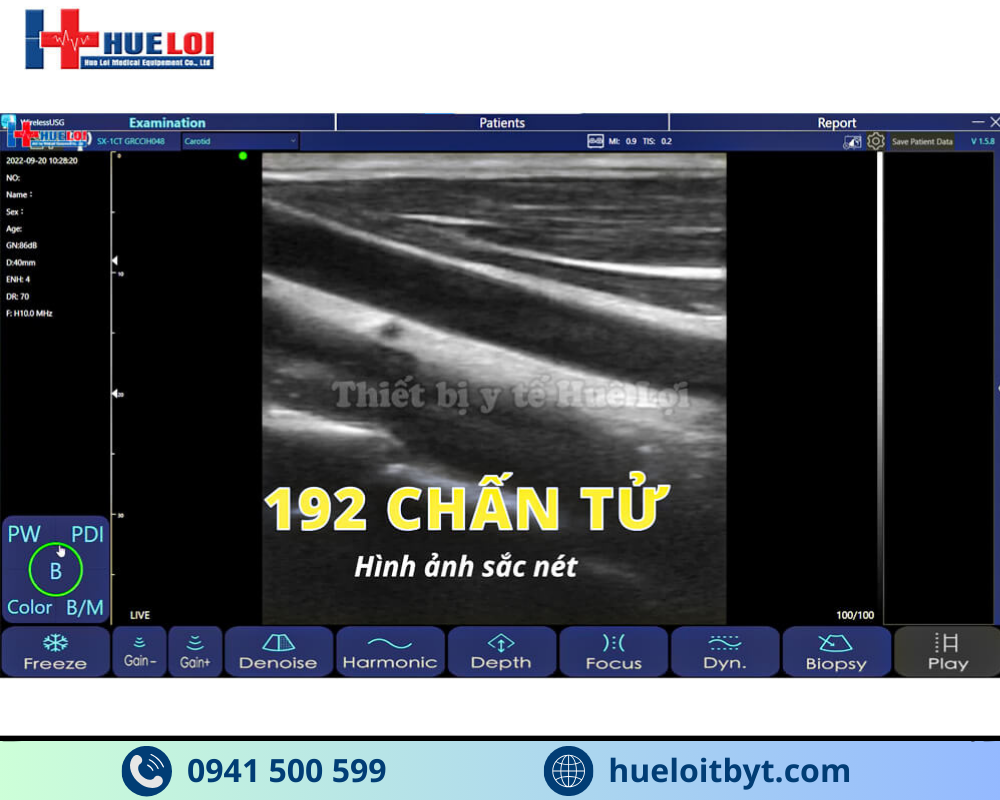 MÁY SIÊU ÂM CẦM TAY KHÔNG DÂY 3 ĐẦU DÒ