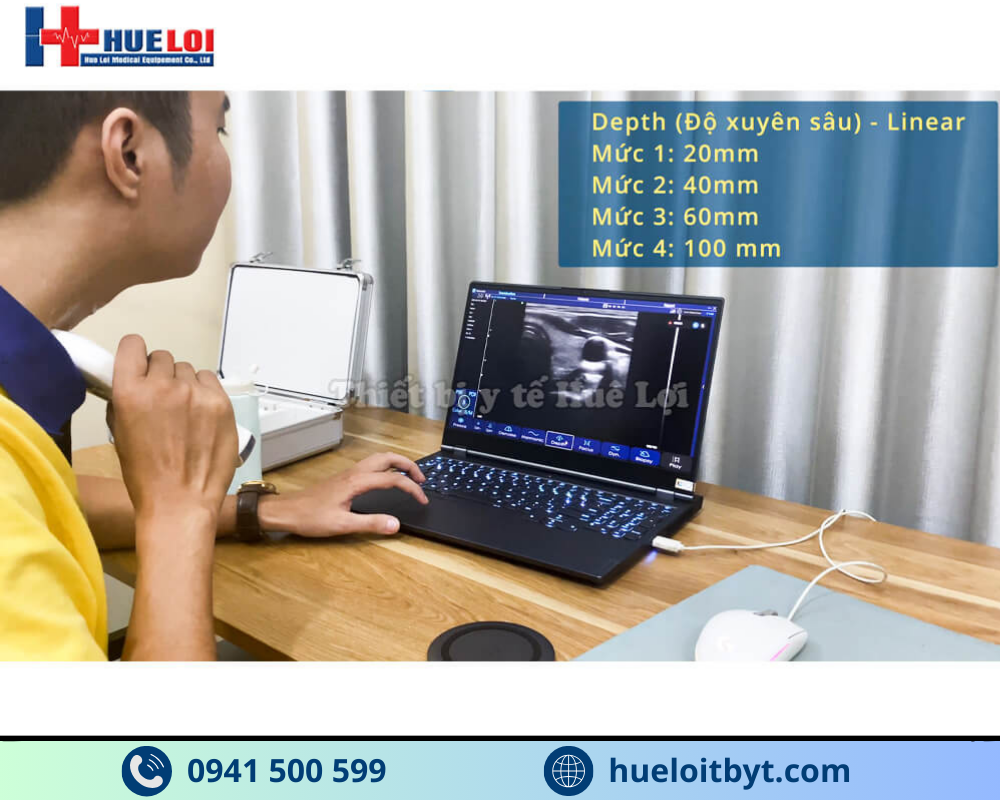 MÁY SIÊU ÂM CẦM TAY KHÔNG DÂY 3 ĐẦU DÒ