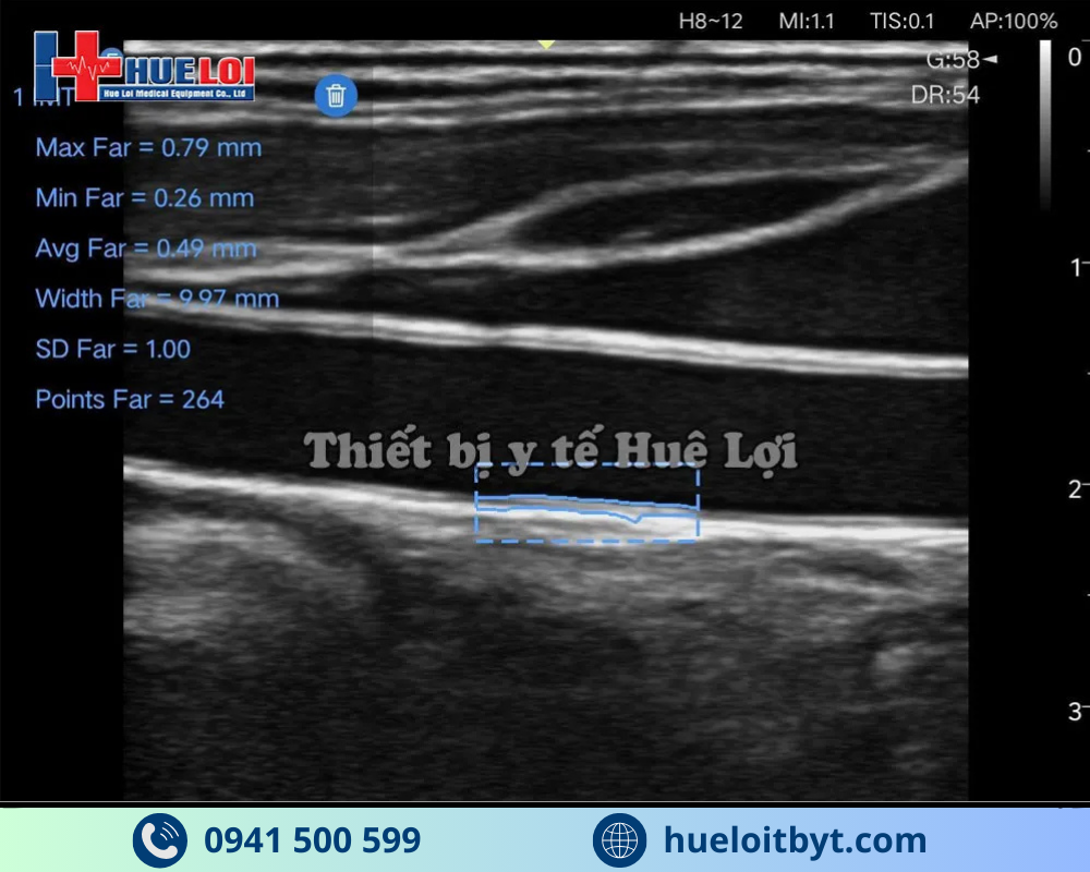 MÁY SIÊU ÂM CẦM TAY EDAN NANO L12 EXP VỚI CÁC CÔNG NGHỆ HIỆN ĐẠI