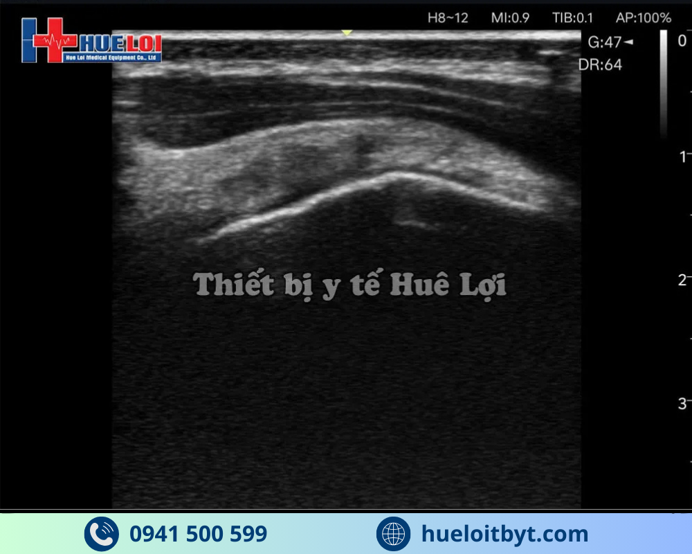 MÁY SIÊU ÂM CẦM TAY EDAN NANO L12 EXP VỚI CÁC CÔNG NGHỆ HIỆN ĐẠI