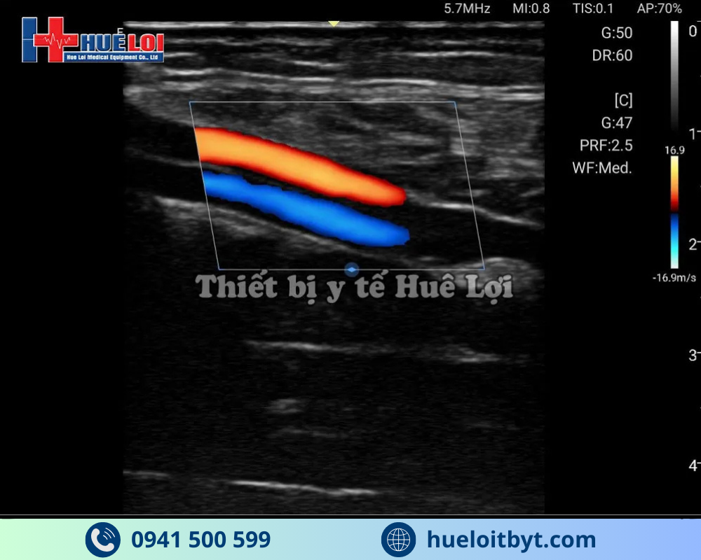 MÁY SIÊU ÂM CẦM TAY EDAN NANO L12 EXP VỚI CÁC CÔNG NGHỆ HIỆN ĐẠI