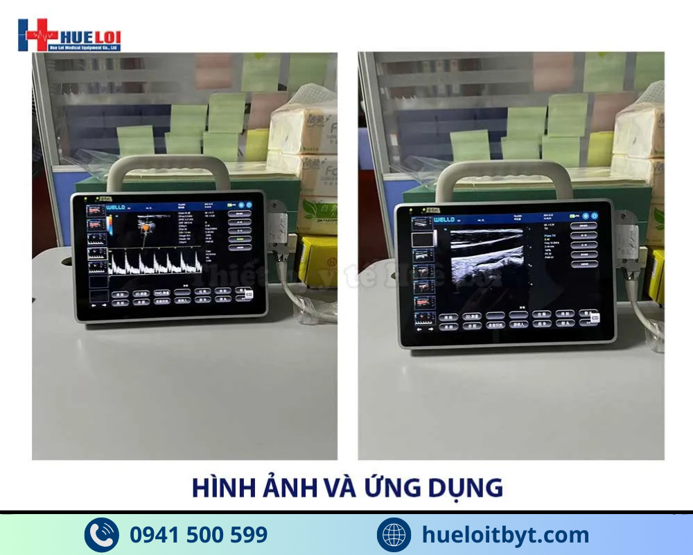 MÁY SIÊU ÂM XÁCH TAY CẢM ỨNG 2 ĐẦU DÒ P10