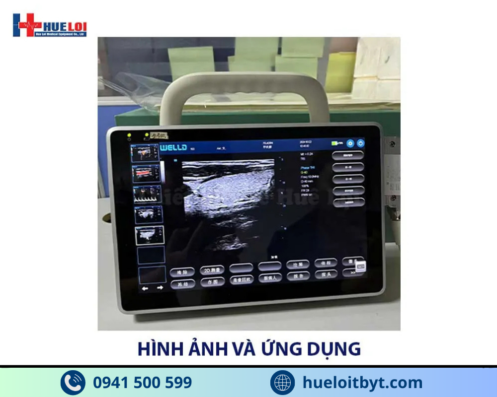 MÁY SIÊU ÂM XÁCH TAY CẢM ỨNG 2 ĐẦU DÒ P10