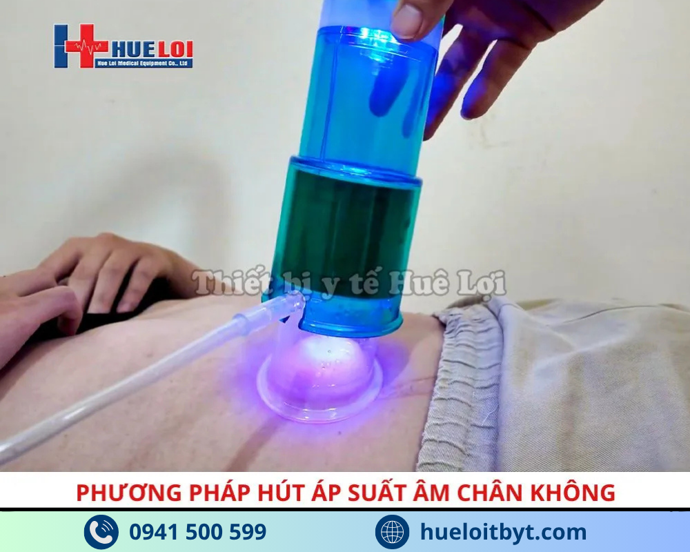 phương pháp hút chân không của máy điều trị xuất tinh sớm