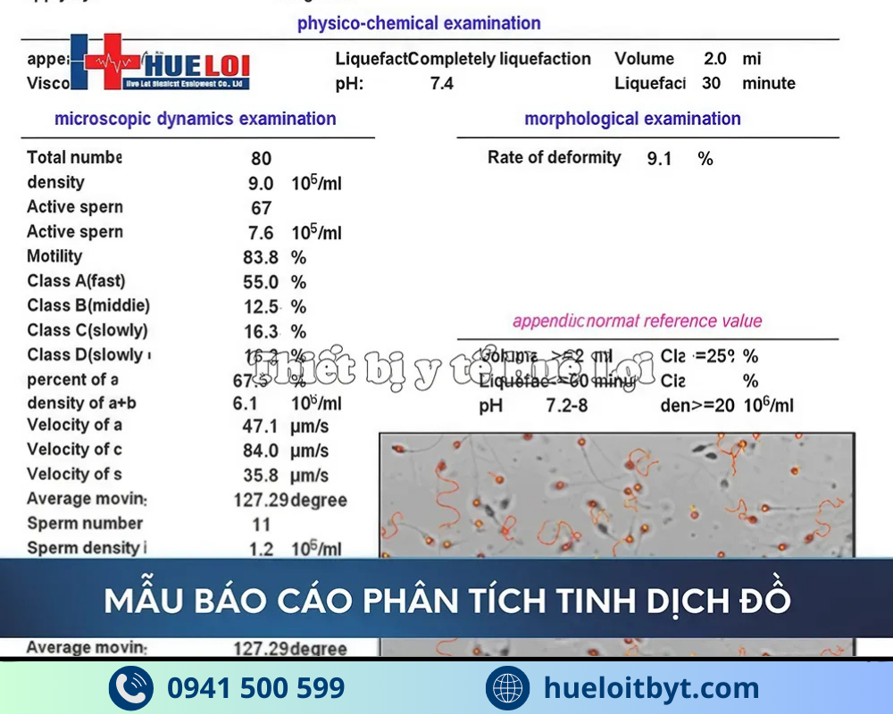 MÁY PHÂN TÍCH TINH DỊCH ĐỒ CHÍNH HÃNG