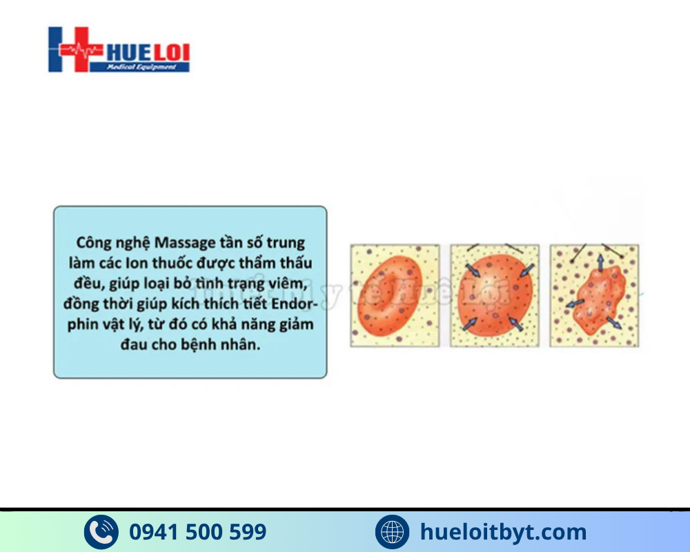 phương pháp massage rung tần số cao điều trị bệnh tuyến tiền liệt
