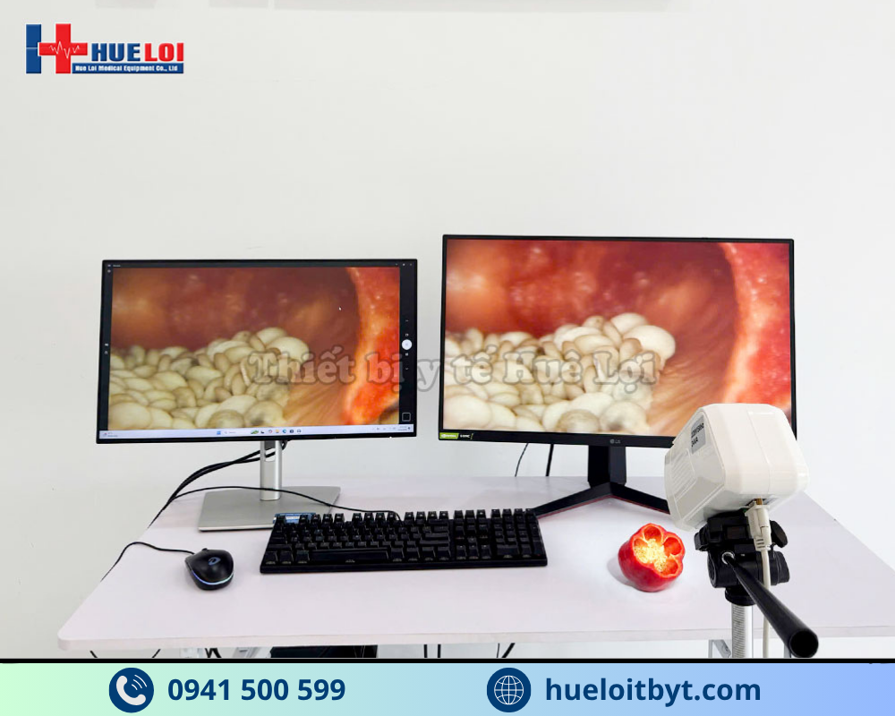 MÁY SOI CỔ TỬ CUNG GIÁ RẺ SW-302