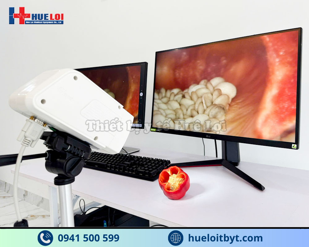 MÁY SOI CỔ TỬ CUNG GIÁ RẺ SW-302