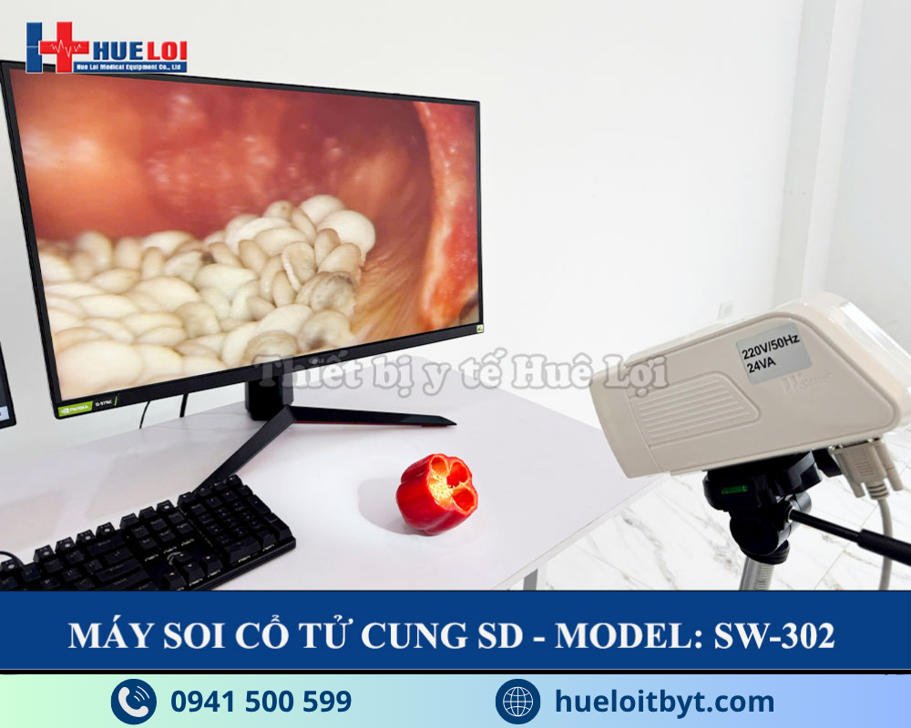 MÁY SOI CỔ TỬ CUNG GIÁ RẺ SW-302