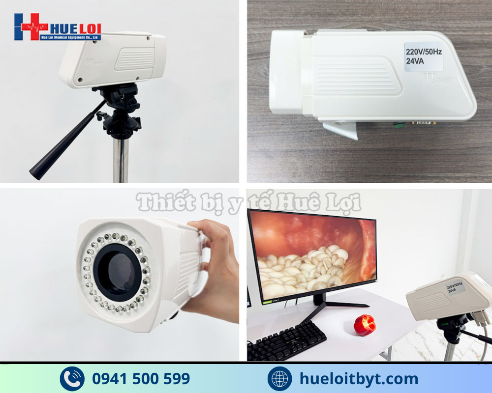 MÁY SOI CỔ TỬ CUNG GIÁ RẺ SW-302