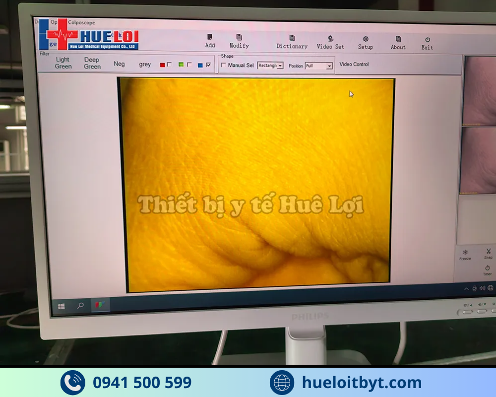 MÁY SOI CỔ TỬ CUNG FULL HD SW-304 GIÁ RẺ