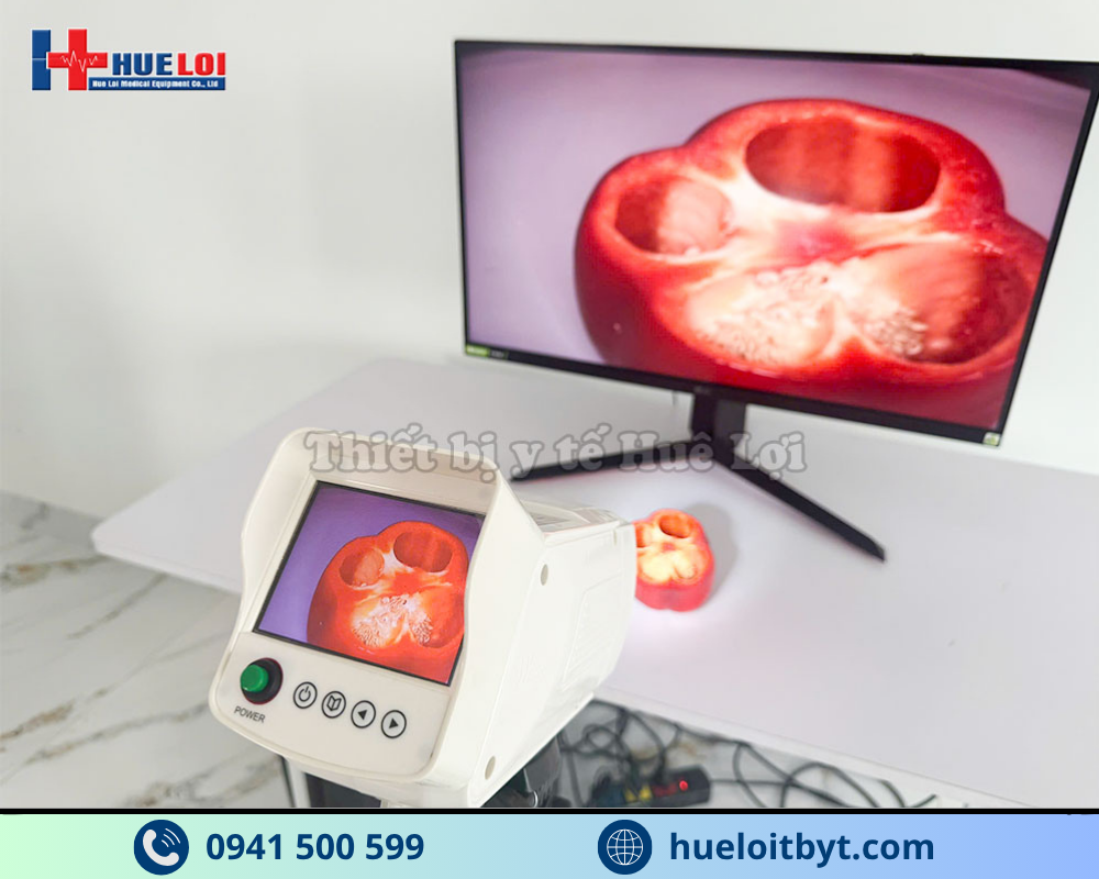MÁY SOI CỔ TỬ CUNG FULL HD SW-304 GIÁ RẺ