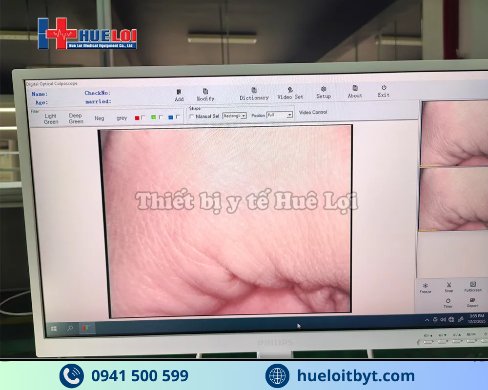 MÁY SOI CỔ TỬ CUNG FULL HD SW-304 GIÁ RẺ