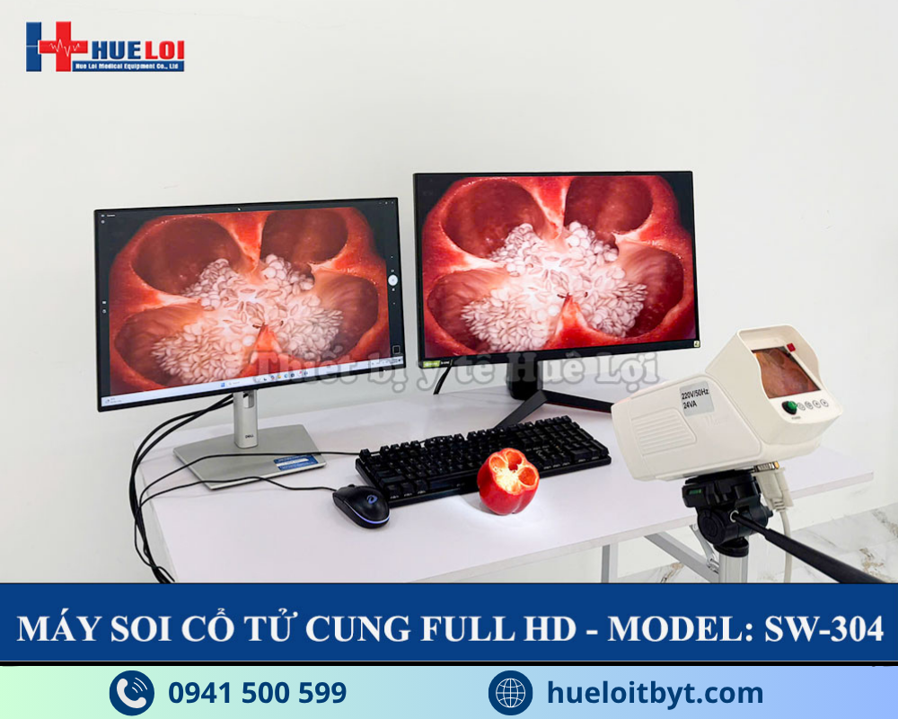 MÁY SOI CỔ TỬ CUNG FULL HD SW-304 GIÁ RẺ
