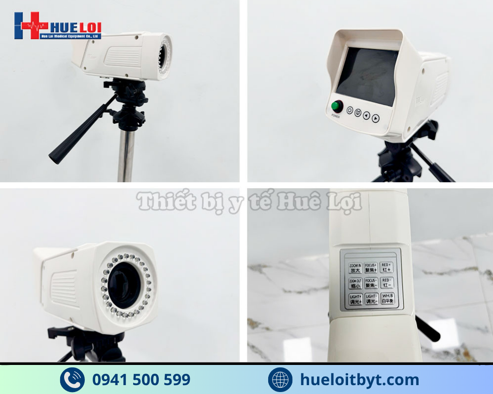 MÁY SOI CỔ TỬ CUNG FULL HD SW-304 GIÁ RẺ