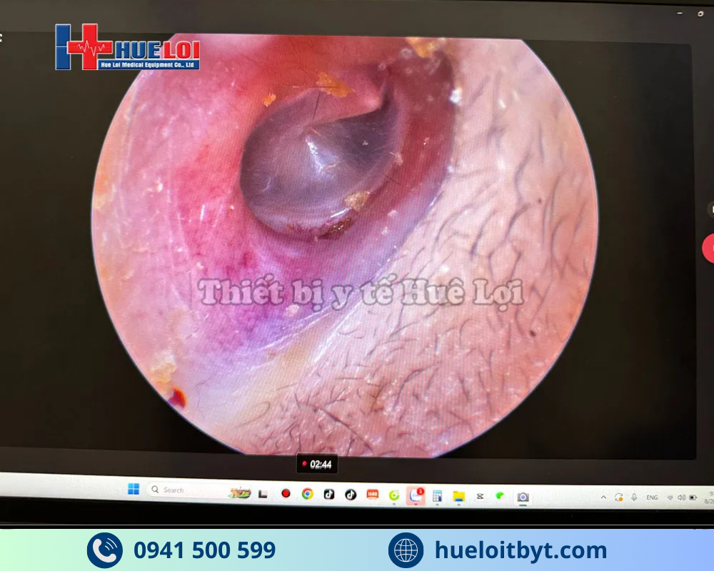 MÁY NỘI SOI TAI MŨI HỌNG MINI FULL HD GIÁ RẺ