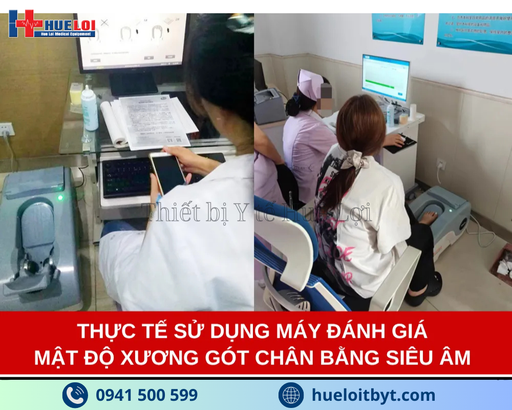 MÁY ĐO MẬT ĐỘ XƯƠNG GÓT CHÂN BẰNG SÓNG SIÊU ÂM OSTEOKJ3000M CAO CẤP