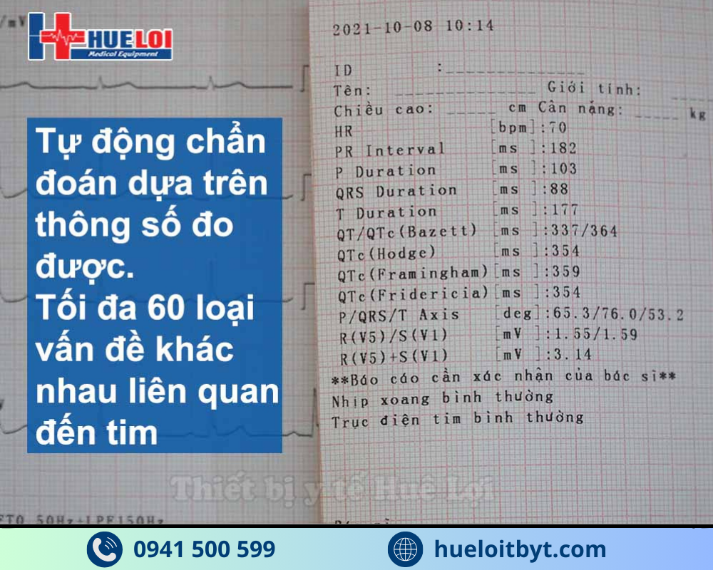 MÁY ĐIỆN TIM 6 KÊNH ECG600G