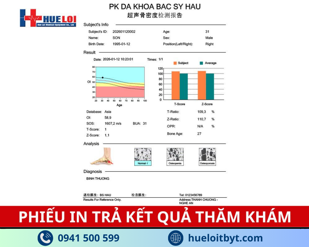 MÁY ĐO LOÃNG XƯƠNG GÓT CHÂN BẰNG SÓNG SIÊU ÂM OSTEOKJ3000 GIÁ TỐT