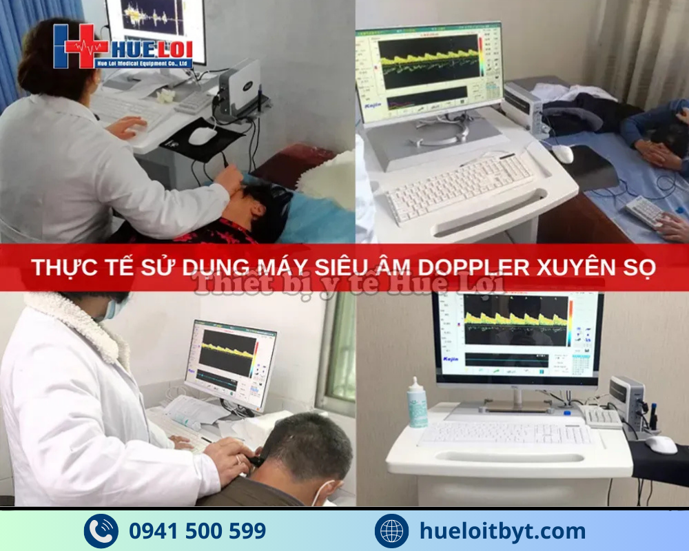 MÁY SIÊU ÂM DOPPLER XUYÊN SỌ KJ-2V4M