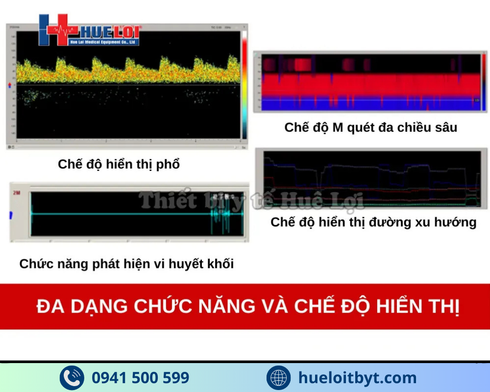 MÁY SIÊU ÂM DOPPLER XUYÊN SỌ KJ-2V4M