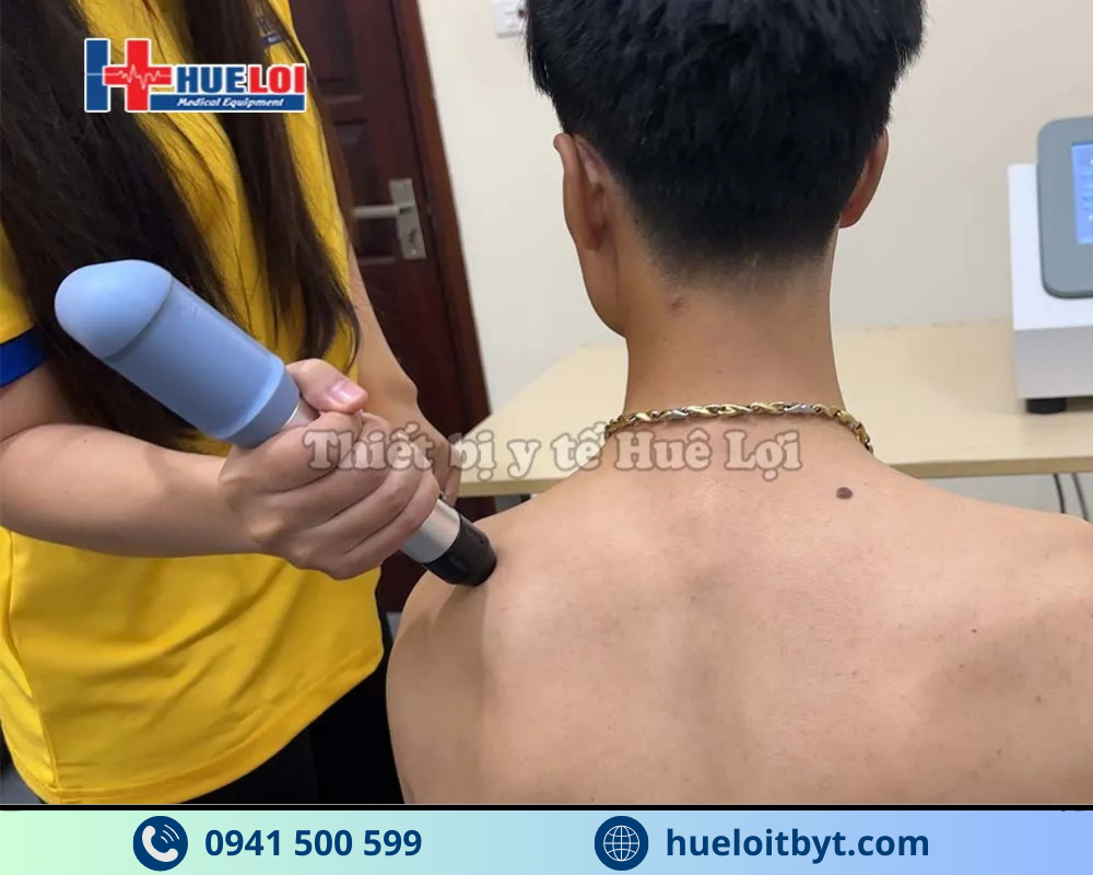 THIẾT BỊ TRỊ LIỆU BẰNG SÓNG XUNG KÍCH T301