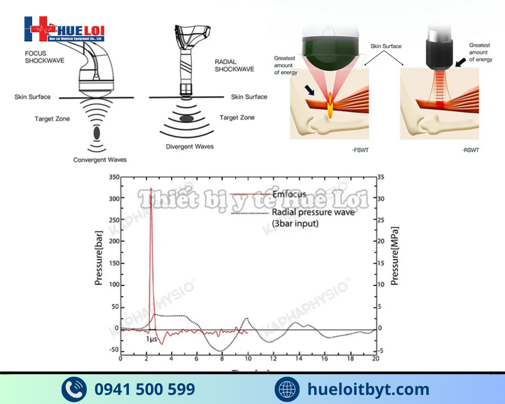 MÁY TRỊ LIỆU BẰNG SÓNG XUNG KÍCH HỘI TỤ CAO CẤP EMFOCUS-III