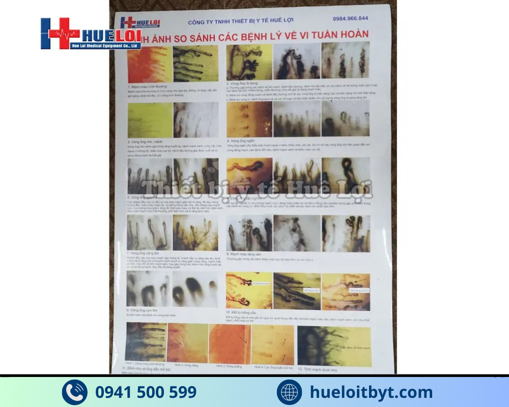 KÍNH HIỂN VI SOI MẠCH MÁU ĐỘ PHÓNG ĐẠI CAO