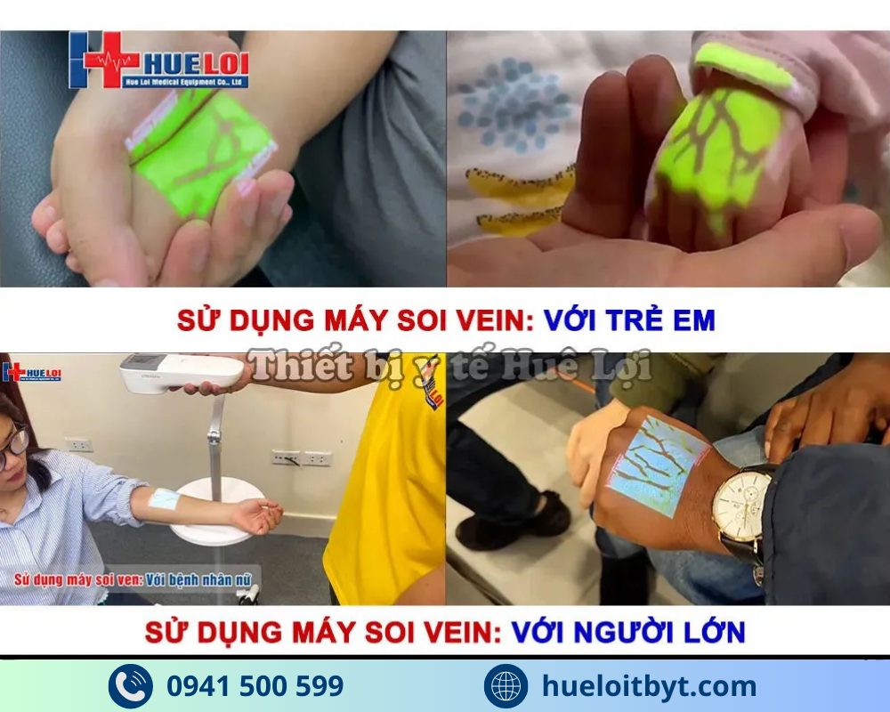 MÁY SOI VEIN CẦM TAY GIÁ RẺ QV-600