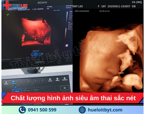 MÁY SIÊU ÂM CHẨN ĐOÁN CAO CẤP EDAN ACCLARIX LX85