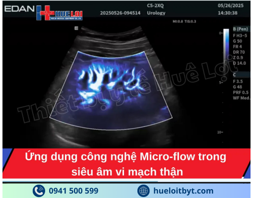 MÁY SIÊU ÂM CHẨN ĐOÁN CAO CẤP EDAN ACCLARIX LX85