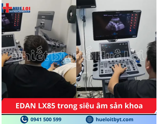 MÁY SIÊU ÂM CHẨN ĐOÁN CAO CẤP EDAN ACCLARIX LX85