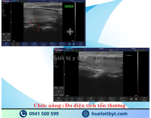 MÁY SIÊU ÂM CẦM TAY KHÔNG DÂY 3 ĐẦU DÒ