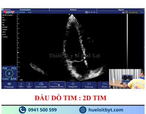 MÁY SIÊU ÂM CẦM TAY KHÔNG DÂY 3 ĐẦU DÒ