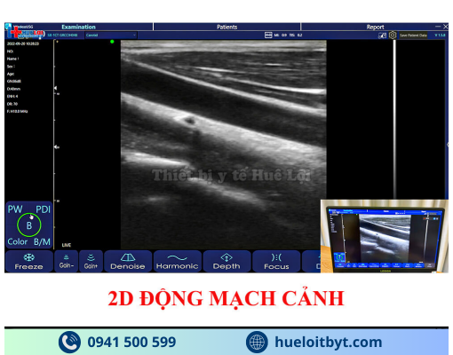 MÁY SIÊU ÂM CẦM TAY KHÔNG DÂY 3 ĐẦU DÒ