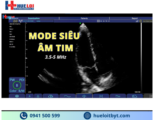 MÁY SIÊU ÂM CẦM TAY KHÔNG DÂY 3 ĐẦU DÒ