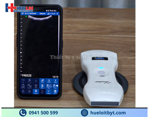 MÁY SIÊU ÂM CẦM TAY KHÔNG DÂY 3 ĐẦU DÒ