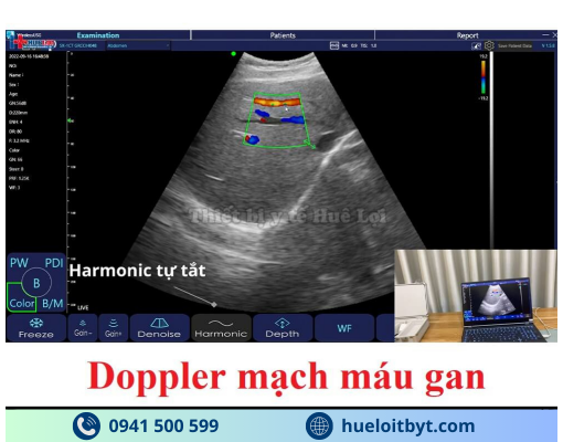 MÁY SIÊU ÂM CẦM TAY KHÔNG DÂY 3 ĐẦU DÒ