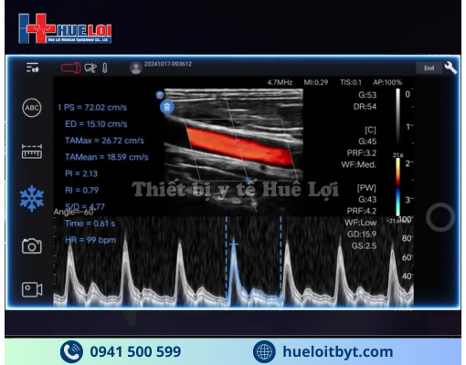 MÁY SIÊU ÂM CẦM TAY EDAN NANO C5 EXP HIỆN ĐẠI
