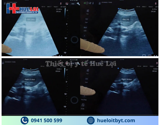 MÁY SIÊU ÂM CẦM TAY EDAN NANO C5 EXP HIỆN ĐẠI