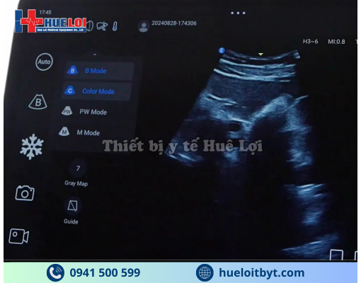 MÁY SIÊU ÂM CẦM TAY EDAN NANO L12 EXP VỚI CÁC CÔNG NGHỆ HIỆN ĐẠI