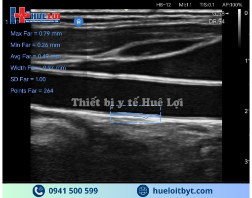 MÁY SIÊU ÂM CẦM TAY EDAN NANO L12 EXP VỚI CÁC CÔNG NGHỆ HIỆN ĐẠI