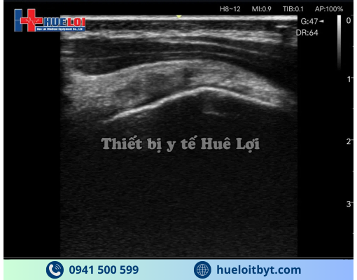 MÁY SIÊU ÂM CẦM TAY EDAN NANO L12 EXP VỚI CÁC CÔNG NGHỆ HIỆN ĐẠI