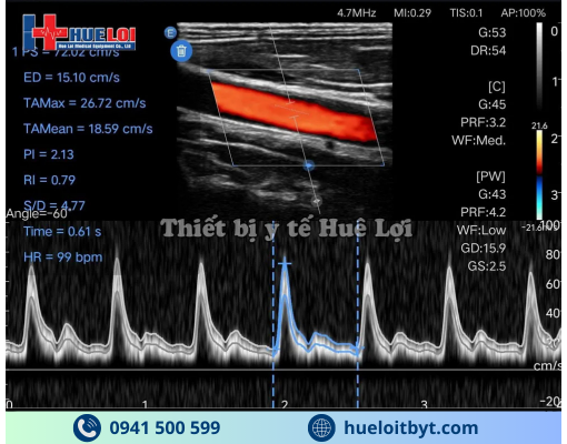 MÁY SIÊU ÂM CẦM TAY EDAN NANO L12 EXP VỚI CÁC CÔNG NGHỆ HIỆN ĐẠI