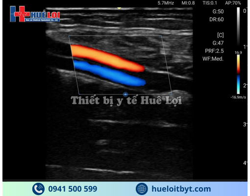 MÁY SIÊU ÂM CẦM TAY EDAN NANO L12 EXP VỚI CÁC CÔNG NGHỆ HIỆN ĐẠI