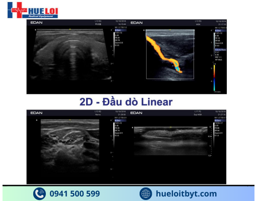 MÁY SIÊU ÂM HÌNH ẢNH EDAN AX3 CAO CẤP