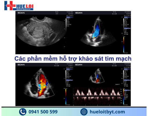 MÁY SIÊU ÂM HÌNH ẢNH EDAN AX3 CAO CẤP