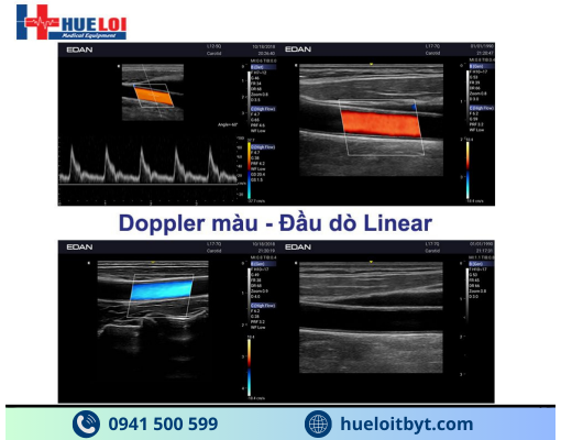 MÁY SIÊU ÂM HÌNH ẢNH EDAN AX3 CAO CẤP